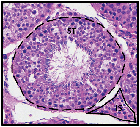 Histology of the testicle: Seminiferous tubule (ST) nourishes sperm, while interstitial space (IS) produces testosterone via Leydig cells.