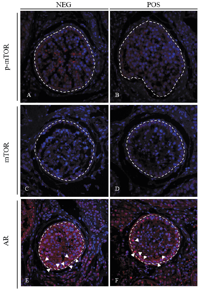 Immunohistochemistry staining of testicular biopsies of bulls on divergent planes of nutrition.