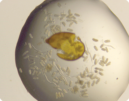 crushed sugarbeet cyst with eggs and juveniles