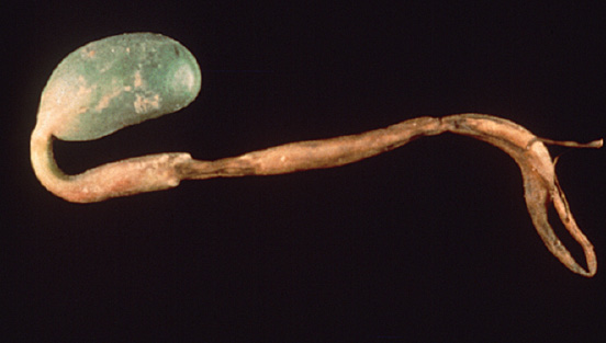 FIGURE 2 – Pre-emergence death of seedling