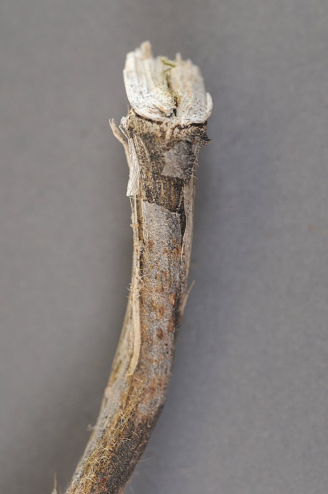 FIGURE 4 – External gray lesion peeling away, revealing profuse 