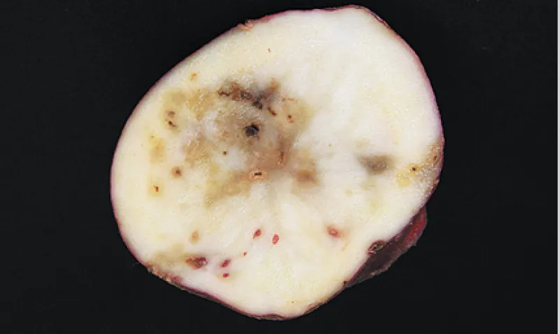 Tobacco Rattle Virus